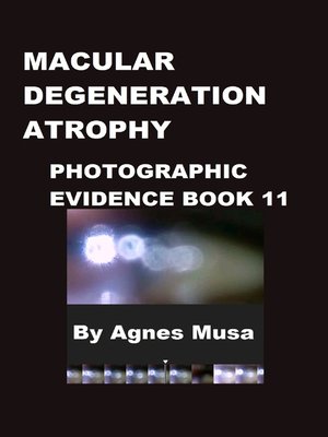 cover image of Macular Degeneration Atrophy, Photographic Evidence Book 11